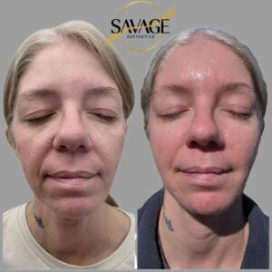 Facial Balancing